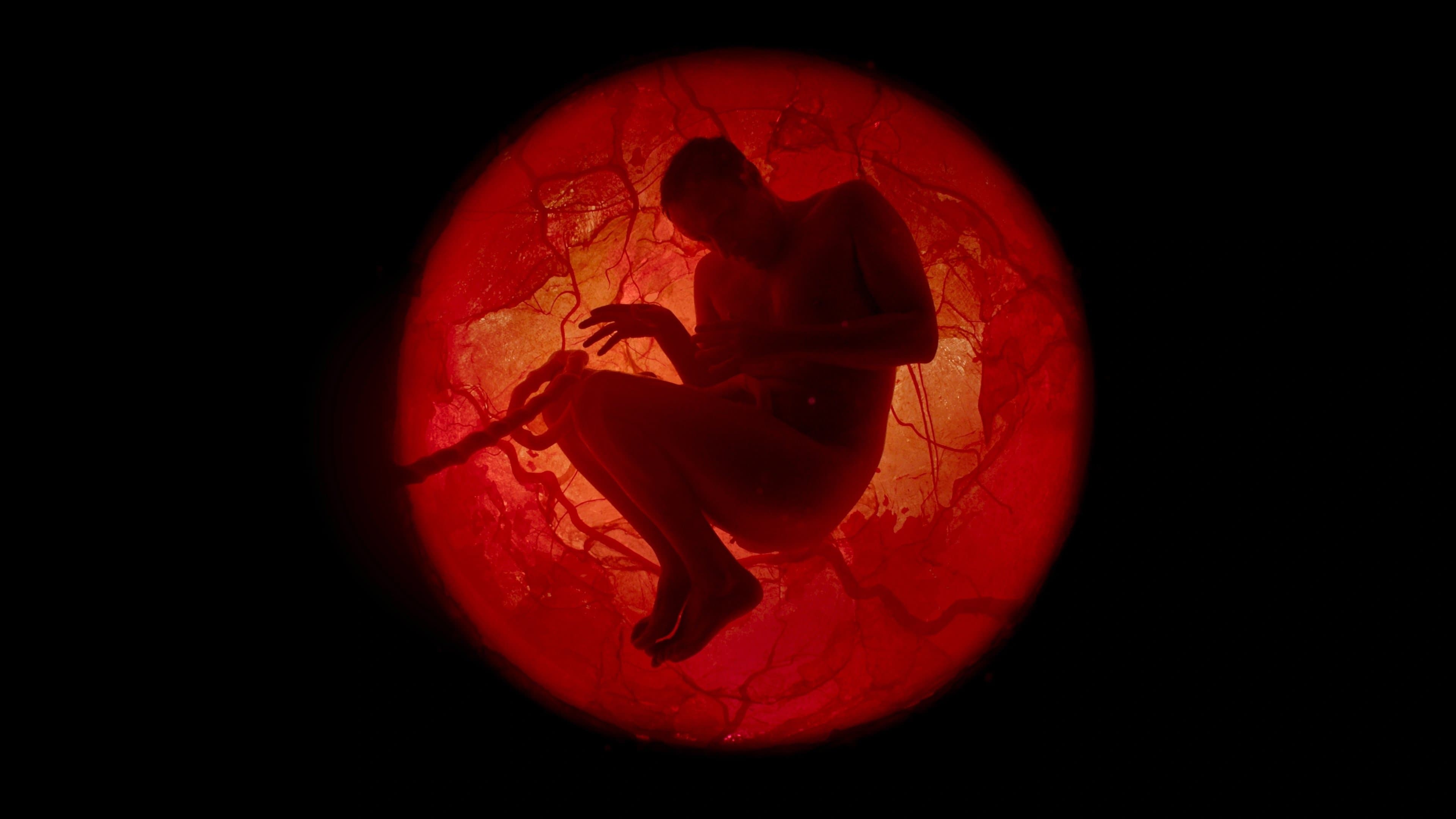 제이미 디미트리우: 홀 라이프타임