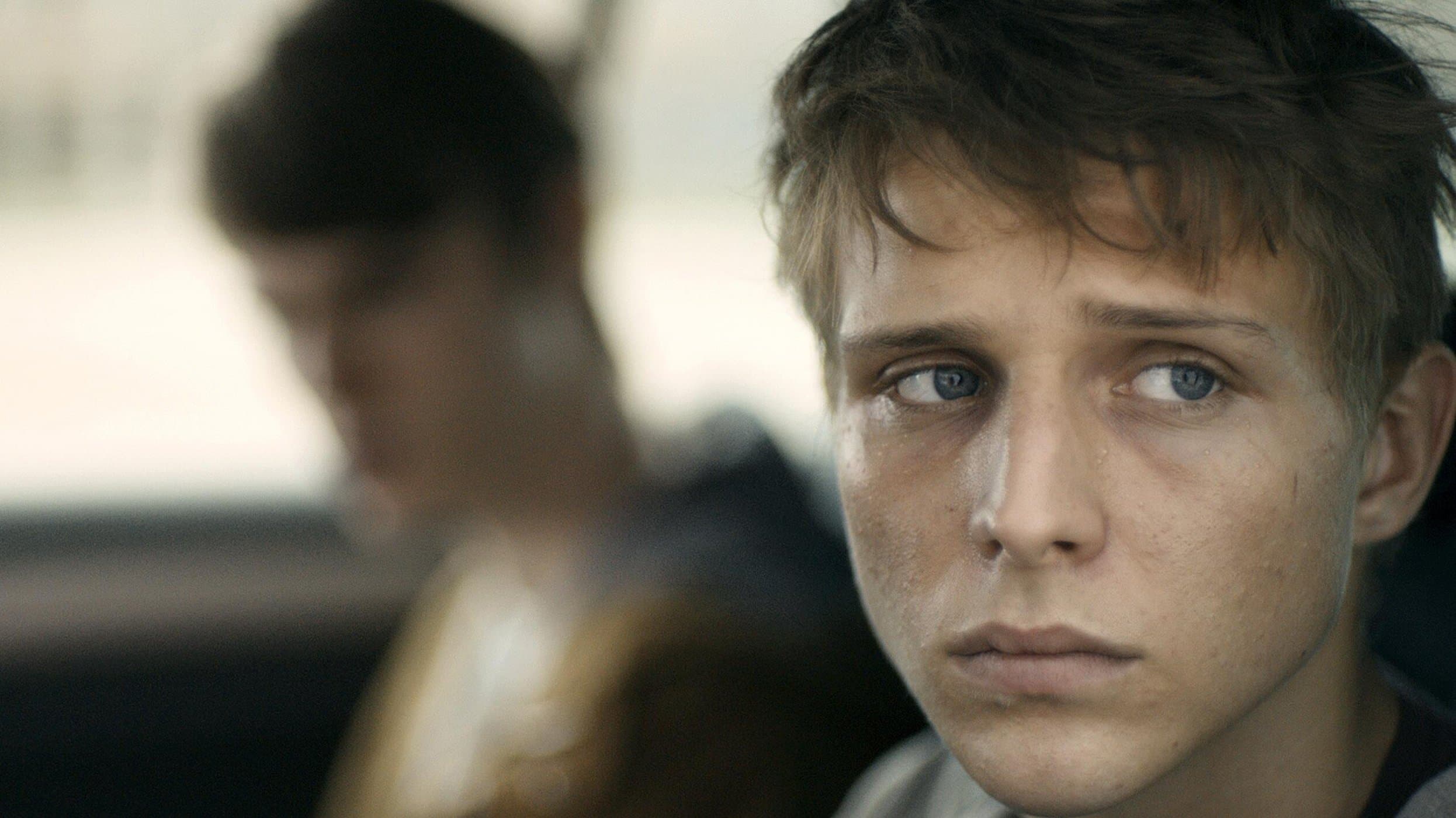 셰드 마이 스킨