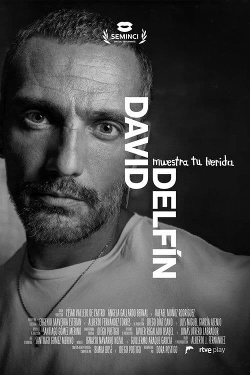 David Delfín, muestra tu herida