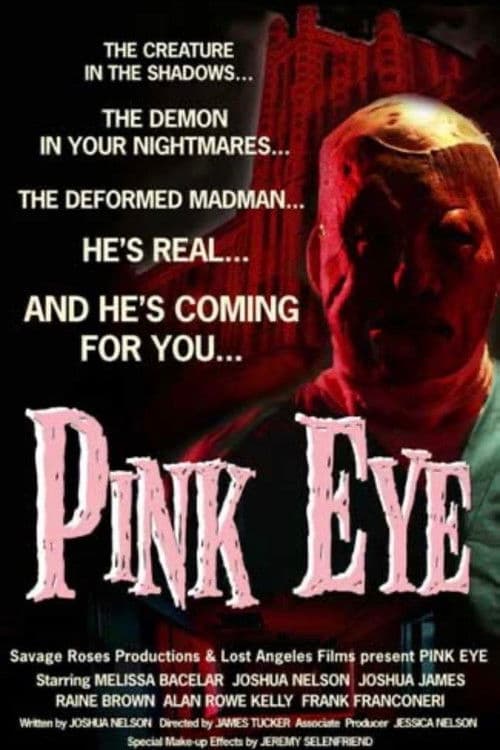 Pink Eye